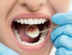 7 Dalang Gigi Tetap Kuning Meski Sudah Rajin Gosok Gigi