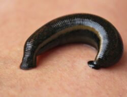 Mimisan Berhari-hari, Lintah Ditemukan Bersarang di Hidung Pria Ini