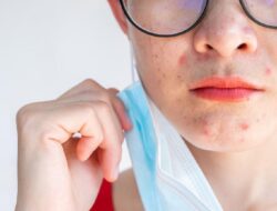 Kesehatan Mental Terganggu Bisa Picu Jerawat Bandel di Wajah