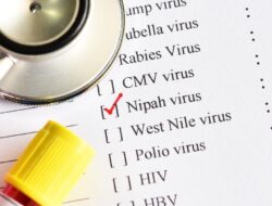Gejala Virus Nipah, Mirip Flu Sampai sekarang Gangguan Otak Berujung Kematian